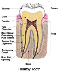 endodontics